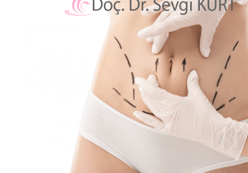 Liposuction